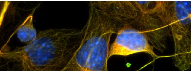 P19 cells differentiating into neurons on day 5 of the process. Cells are stained for α-tubulin (green), βIII-tubulin (red), and DNA (blue). Performed by Bea Carbone in Hampshire College Natural Science laboratories